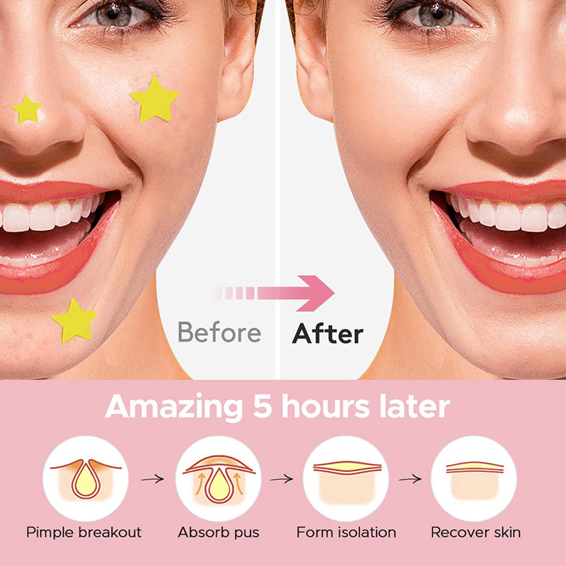 600개/세트 별 모양 여드름 패치 컬러풀 투명 여드름 - Skincare 리뷰 및 가격